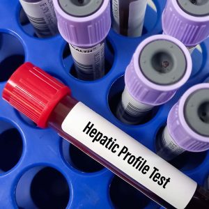 Perfil Hepático a Domicilio