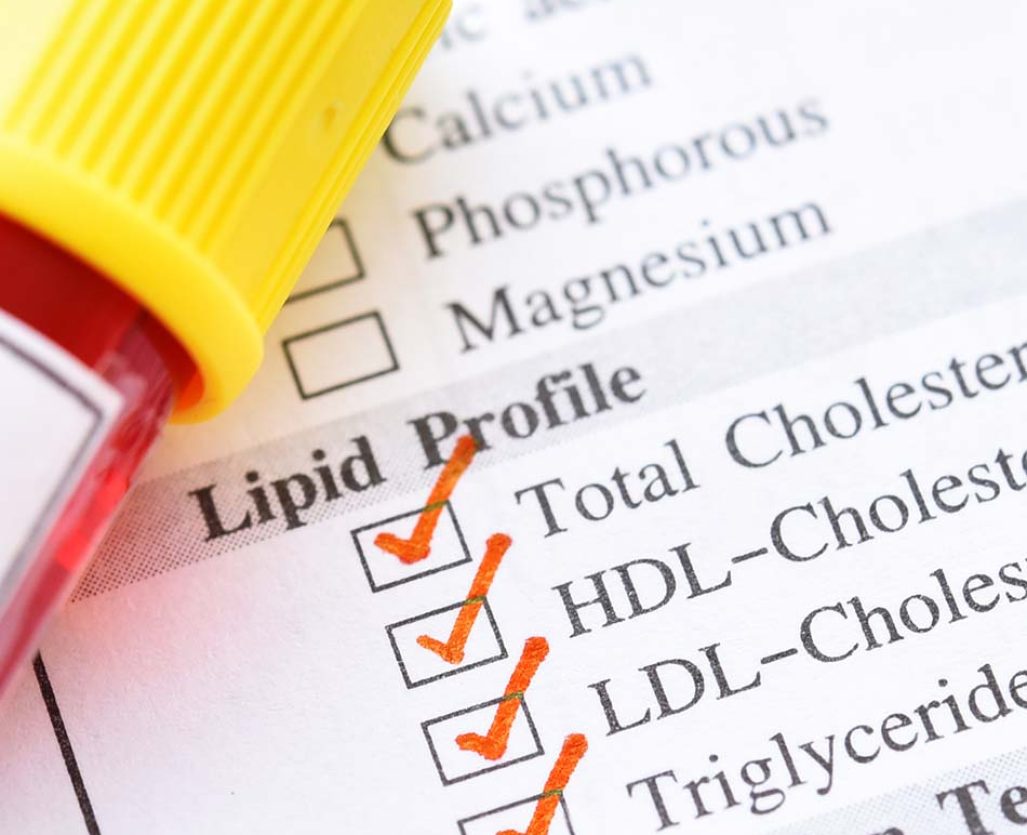perfil-lipidico-a-domicilio